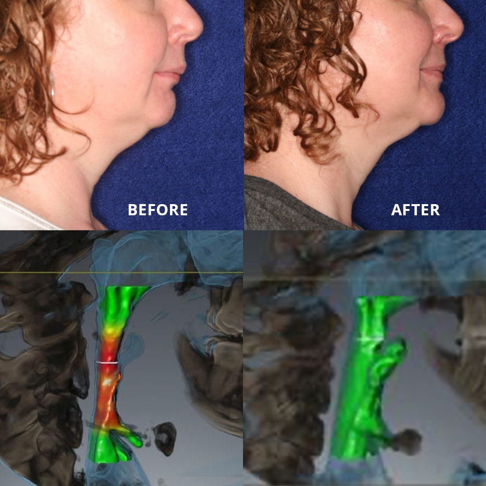 Edmond Oklahoma Cosmetic Dentist