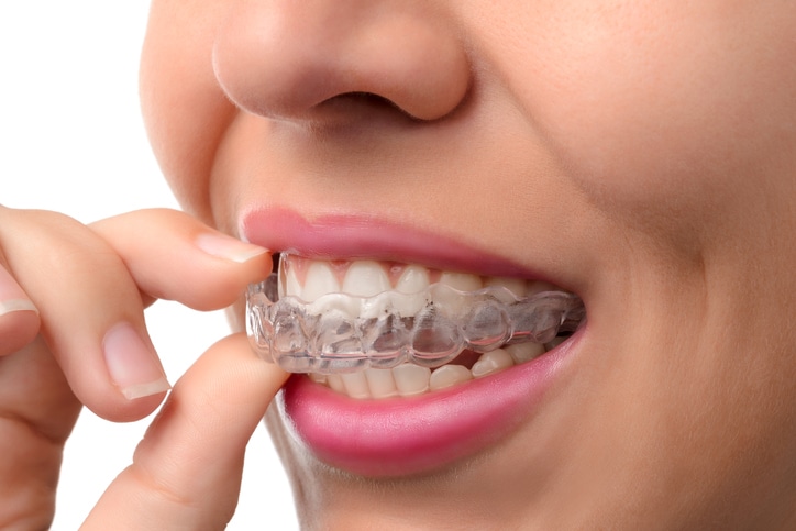 Invisalign Santa Fe