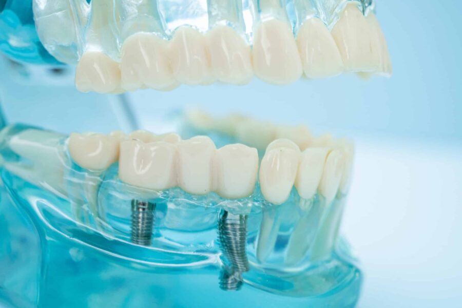 removable prosthodontics